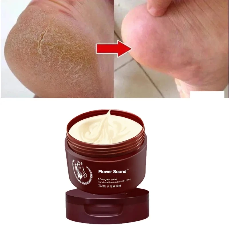 120g Horse Oil Foot Cream for Dry, Rough & Cracked Feet
